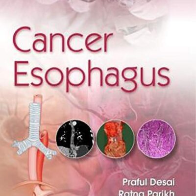 CANCER ESOPHAGUS (PB 2020) [Paperback] PRAFUL DESAI
