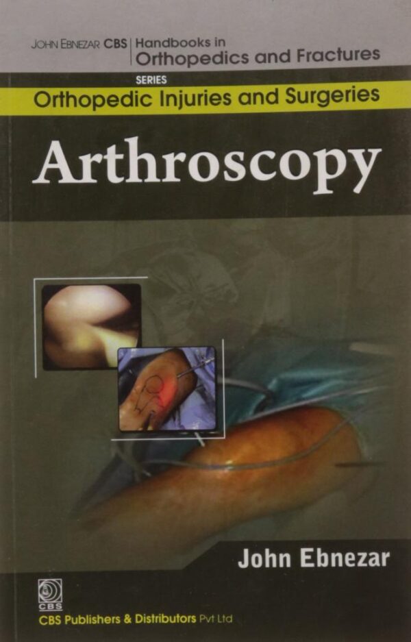 ARTHROSCOPY (HANDBOOKS IN ORTHOPEDICS AND FRACTURES SERIES