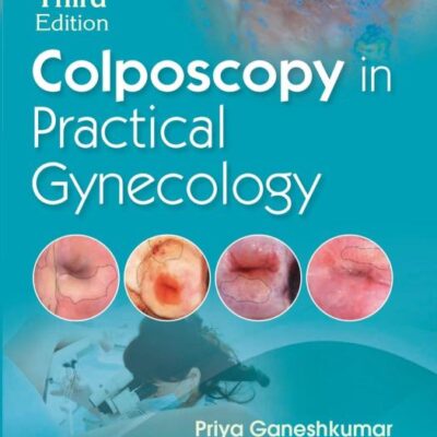 Colposcopy in Practical Gynecology