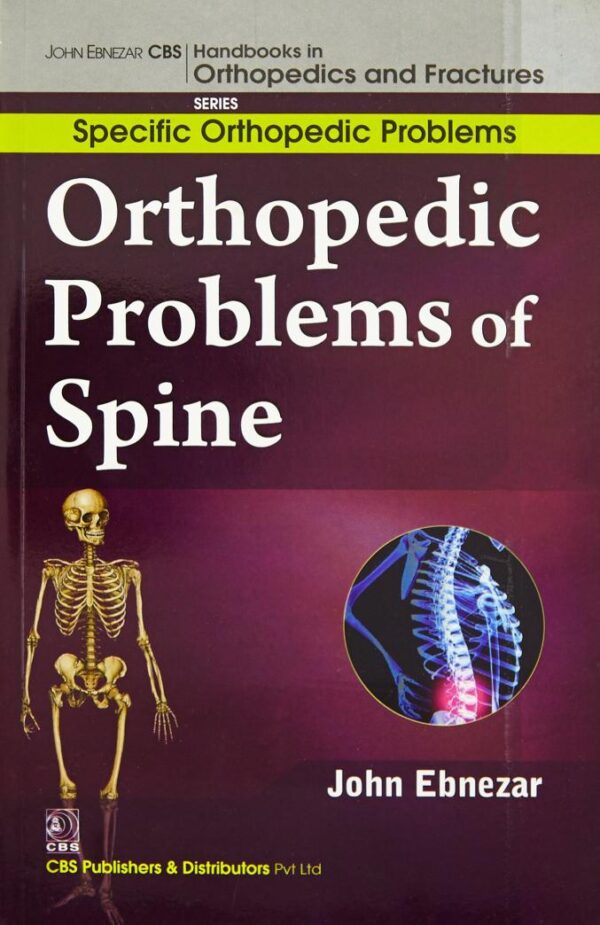 Orthopedic Problems Of Spine (Handbooks In Orthopedics and Fractures Series