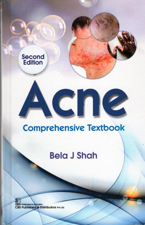 Acne Comprehensive Textbook 2/ed - 2025