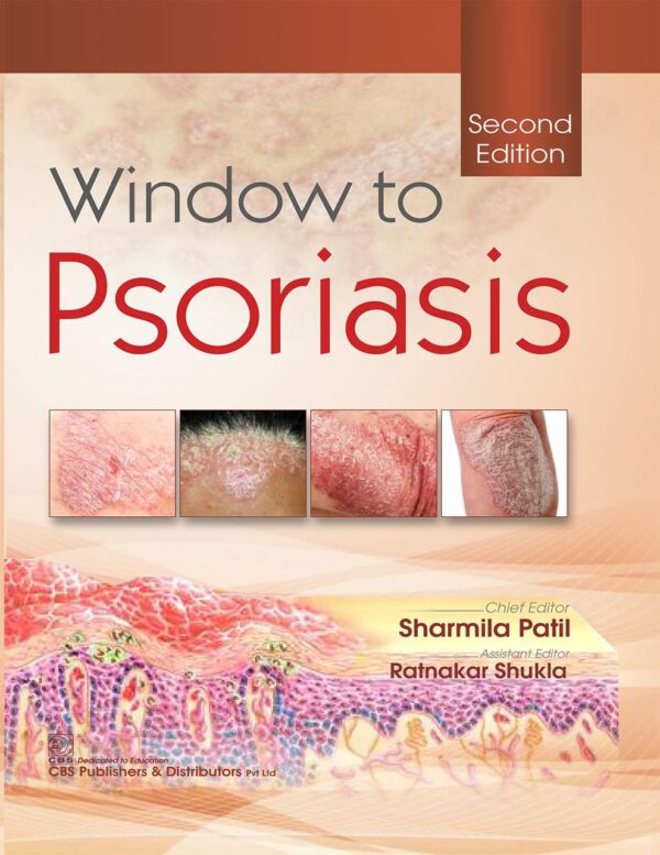 Window to Psoriasis
