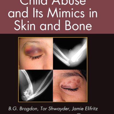 Child Abuse and Its Mimics in Skin and Bone