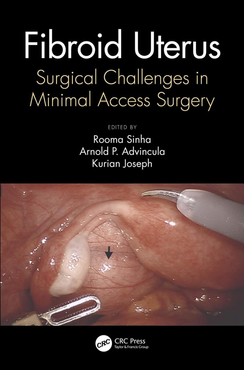 FIBROID UTERUS SURGICAL CHALLENGES IN MINIMAL ACCESS SURGERY (HB 2021)