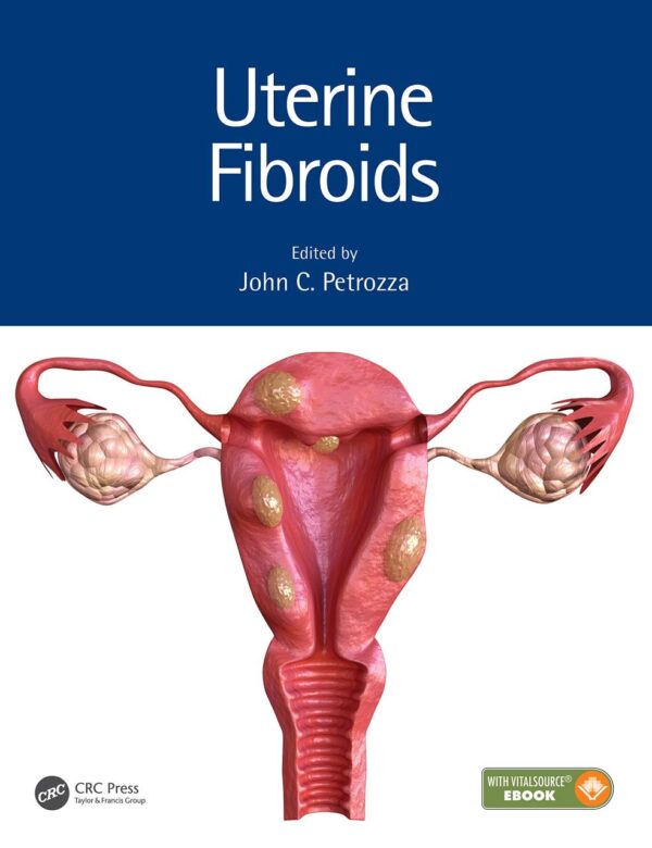UTERINE FIBROIDS (HB 2021)