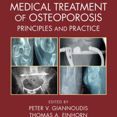 Surgical and Medical Treatment of Osteoporosis: Principles and Practice