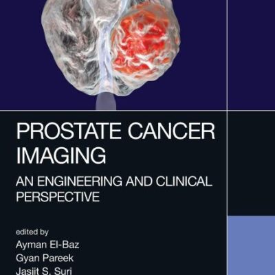 Prostate Cancer Imaging: An Engineering and Clinical Perspective