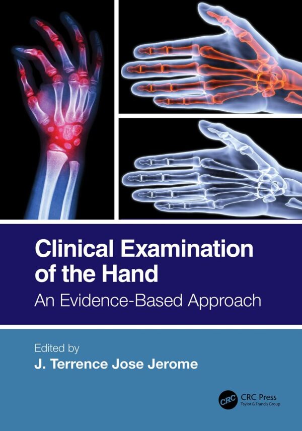 CLINICAL EXAMINATION OF THE HAND AN EVIDENCE BASED APPROACH (PB 2022)