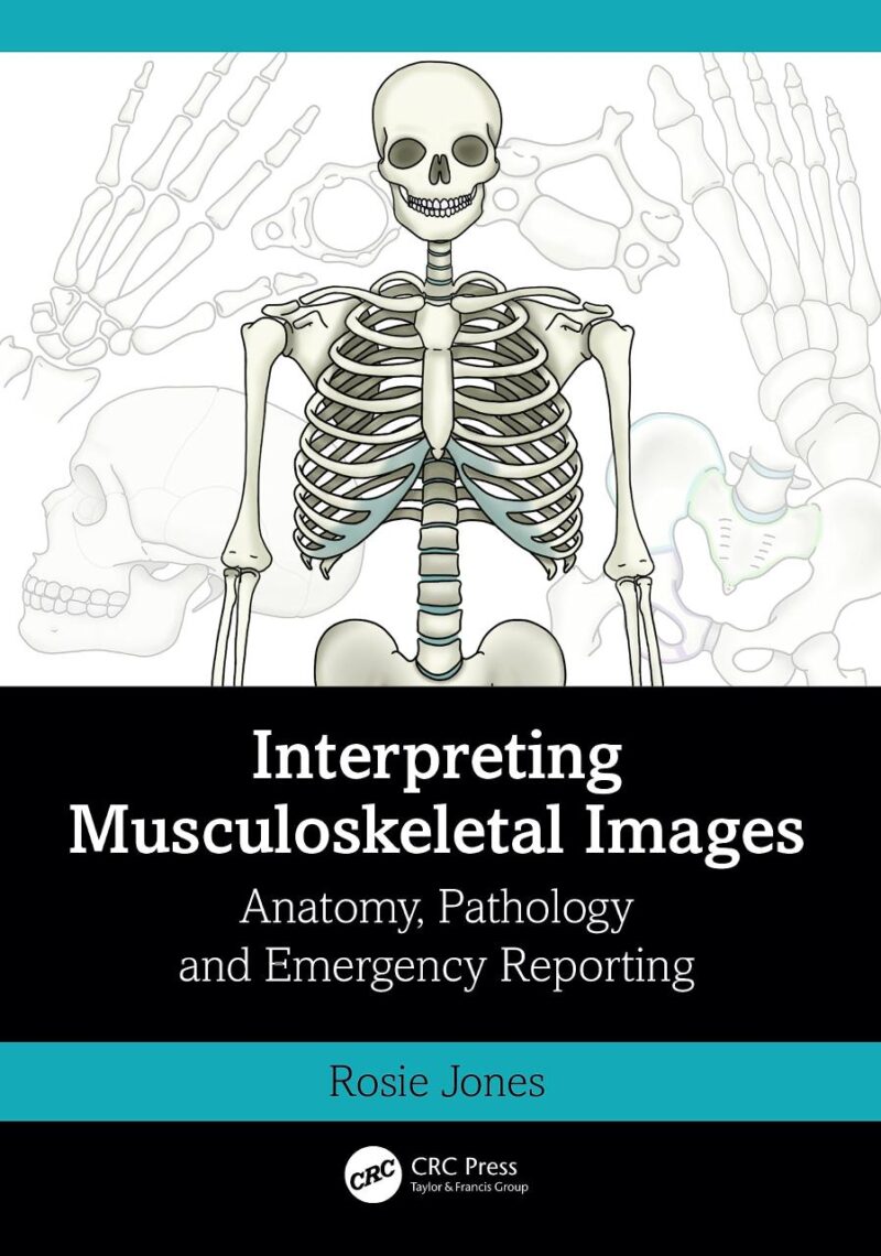 Interpreting Musculoskeletal Images: Anatomy