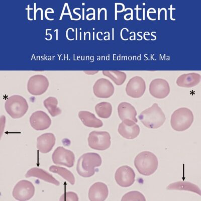 Haematology and the Asian Patient