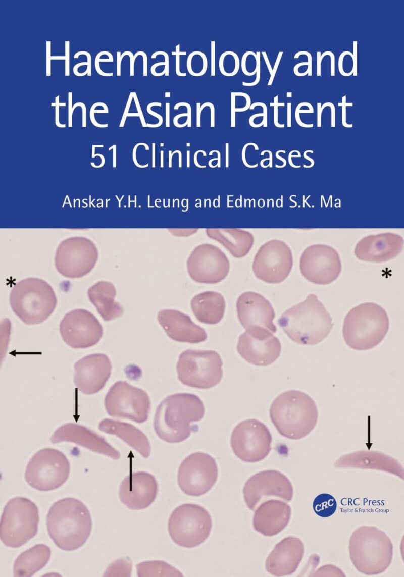 Haematology and the Asian Patient
