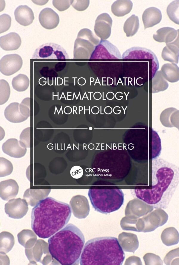 Guide To Paediatric Haematology Morphology