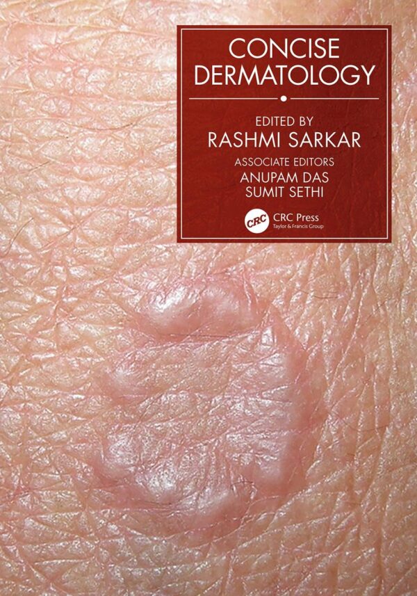 CONCISE DERMATOLOGY (PB 2021)
