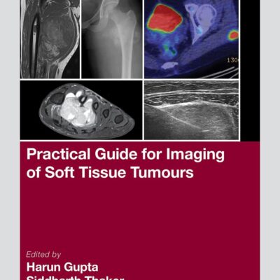 Practical Guide for Imaging of Soft Tissue Tumours