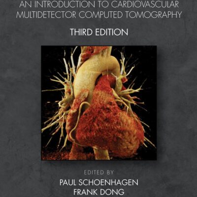 Cardiac CT Made Easy