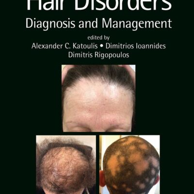 Hair Disorders
