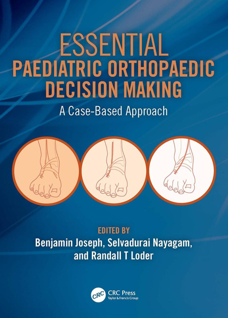 Essential Paediatric Orthopaedic Decision Making A Case Based Approach (Pb 2022)