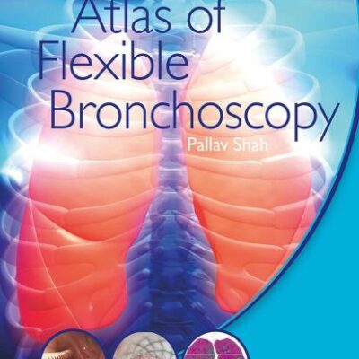Atlas of Flexible Bronchoscopy