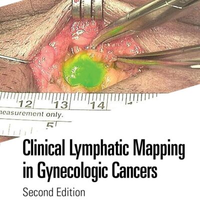 Clinical Lymphatic Mapping in Gynecologic Cancers