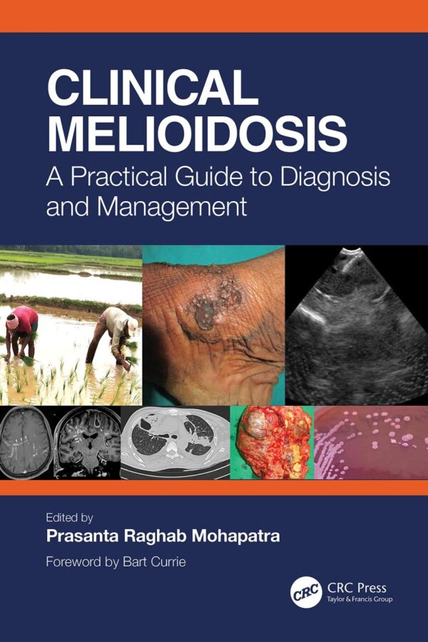 Clinical Melioidosis A Practical Guide To Diagnosis And Management (Pb 2023)