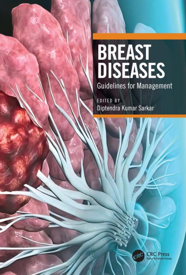 Breast Diseases Guidelines For Management (Pb 2024)