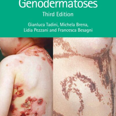 Atlas of Genodermatoses