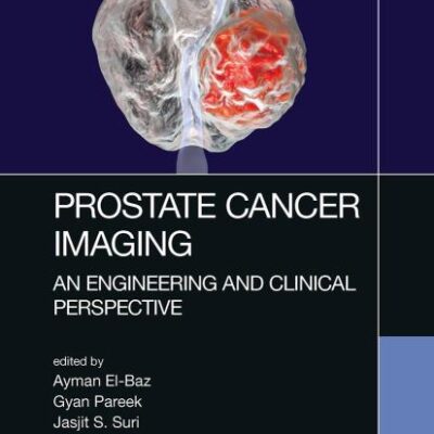 Prostate Cancer Imaging: An Engineering and Clinical Perspective
