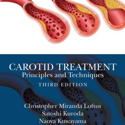 Carotid Treatment: Principles and Techniques