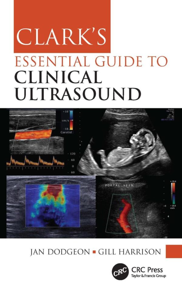 Clark'S Essential Guide To Clinical Ultrasound