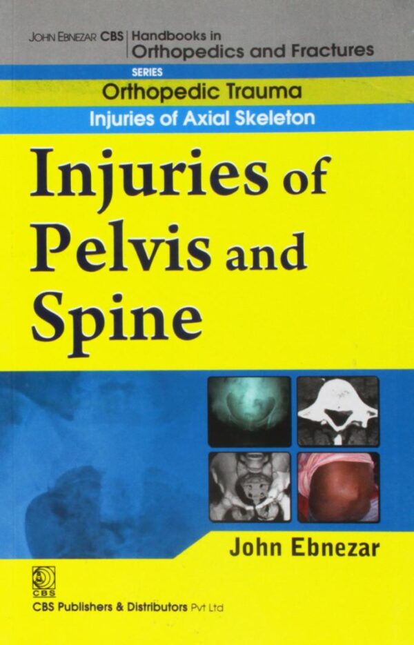 INJURIES OF PELVIS AND SPINE (HANDBOOKS IN ORTHOPEDICS AND FRACTURES SERIES