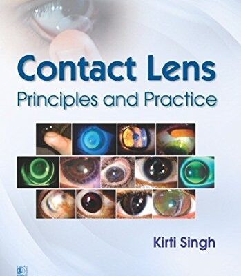 CONTACT LENS PRINCIPLES AND PRACTICE (PB 2017) [Paperback] SINGH K