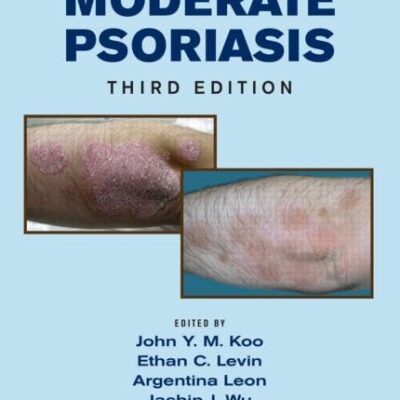 MILD TO MODERATE PSORIASIS 3ED
