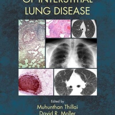 CLINICAL HANDBOOK OF INTERSTITIAL LUNG DISEASE (PB 2018)