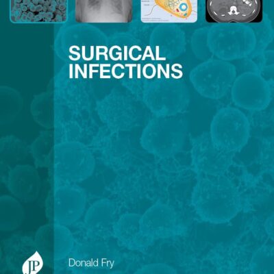 Surgical Infections