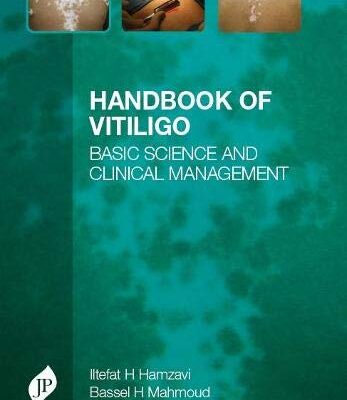 Handbook of Vitiligo: Basic Science and Clinical Management
