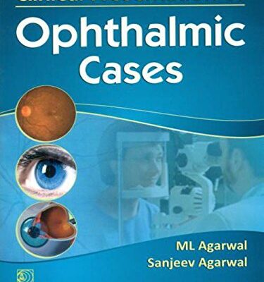Clinical Presentation Of Opthalmic Cases (Pb2014) [Paperback] AGARWAL M.L.