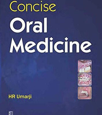 Concise Oral Medicine (Pb 2019) [Paperback] Umarji H