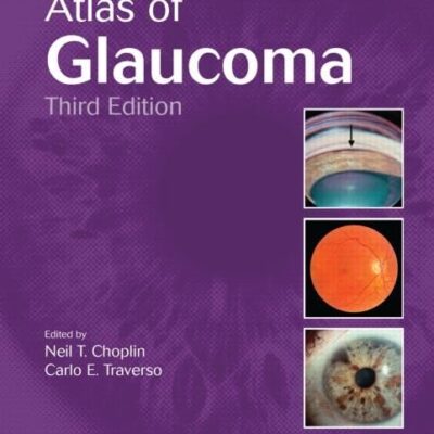 ATLAS OF GLAUCOMA 3ED (HB 2014)
