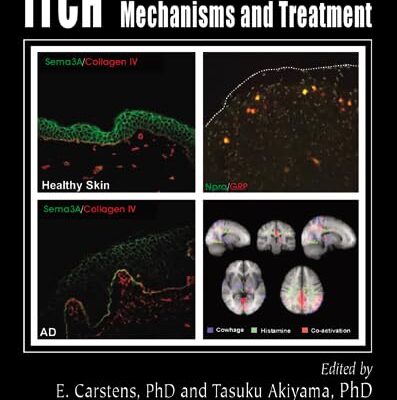 Itch: Mechanisms and Treatment: 56 (Frontiers in Neuroscience)
