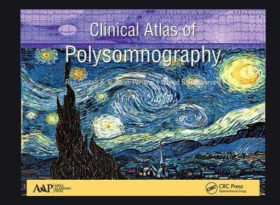 Clinical Atlas Of Polysomnography