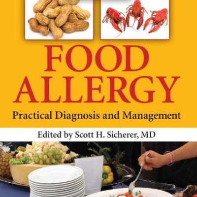 Food Allergy: Practical Diagnosis and Management