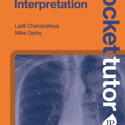Chest X-Ray Interpretation (Pocket Tutor) (POD): Second Edition
