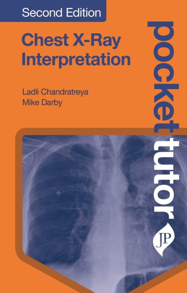 Chest X-Ray Interpretation (Pocket Tutor) (POD): Second Edition