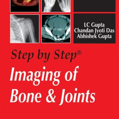 Step by Step Imaging of Bone & Joints with Photo CD-ROM