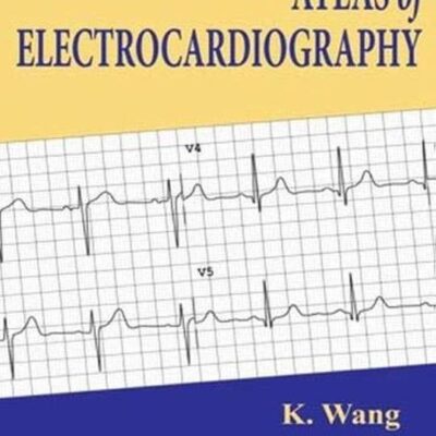 Atlas of Electrocardiography
