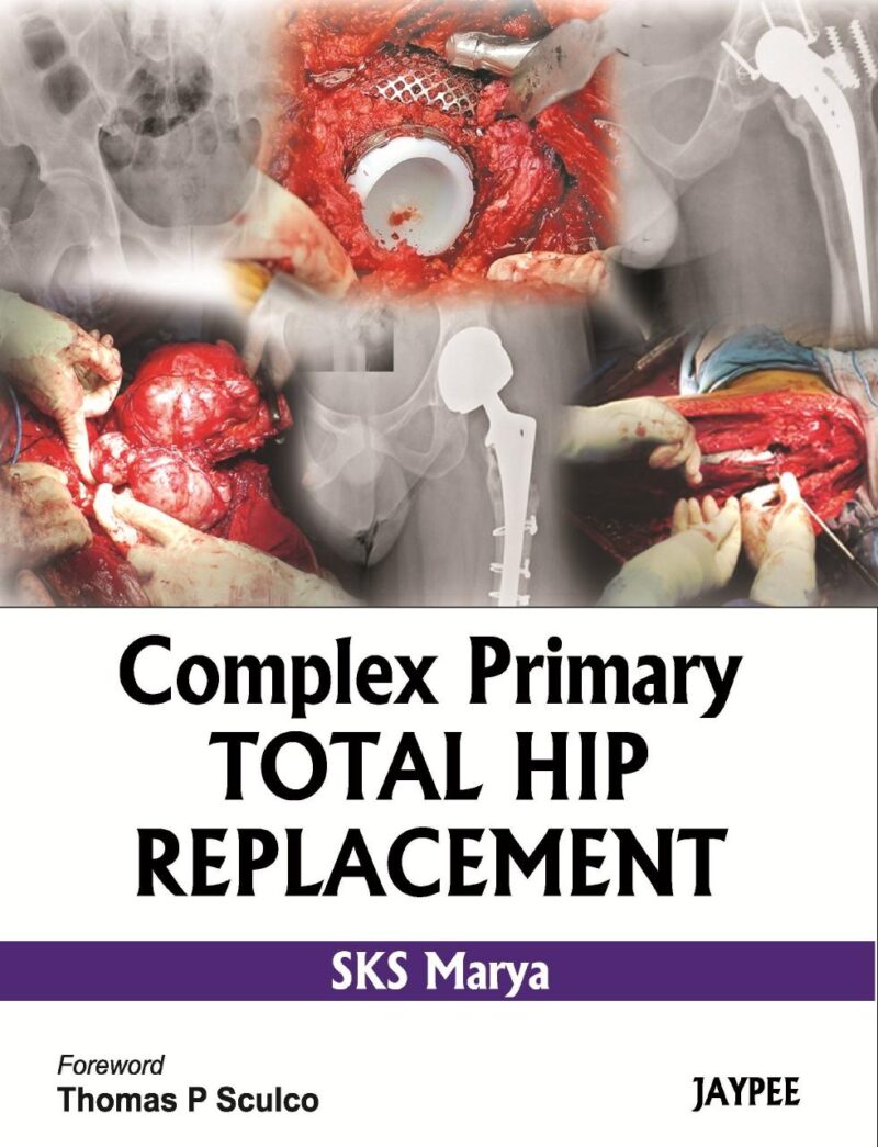 Complex Primary Total Hip Replacement