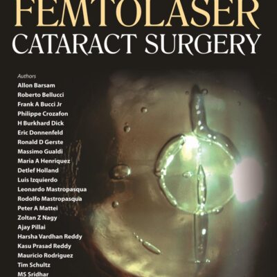 FEMTOLASER CATARACT SURGERY