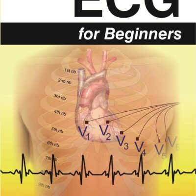 ECG for Beginners