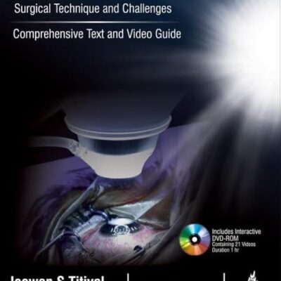SMALL INCISION LENTICULE EXTRACTION (SMILE) SURGICAL TECHNIQUE AND CHALLENGES:COMPREHENSIVE TEXT
