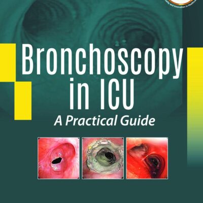 Bronchoscopy in ICU